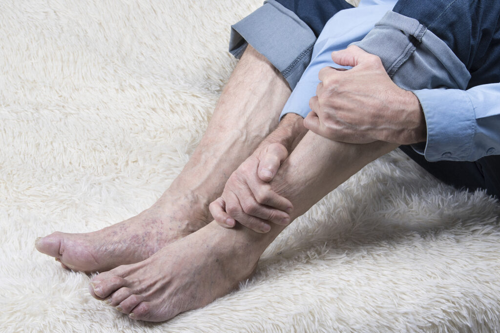 Senior Arthritis: Home Care Falls Church VA